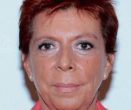 MISURE DI ARMONIZZAZIONE PER L'ACCESSO ALLE PENSIONI 